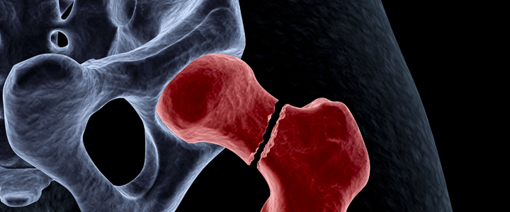 root-canal-treatment-banner Root Canal Treatment in Sector 120 Noida